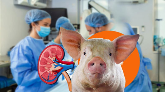 Paciente que recibió primer trasplante de riñón de cerdo modificado genéticamente, fallece