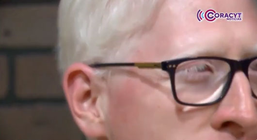¿Qué es el albinismo?